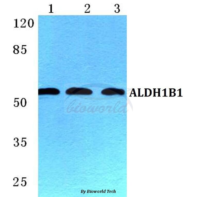 Anti-ALDH1B1 Antibody from Bioworld Technology (BS5604) - Antibodies.com