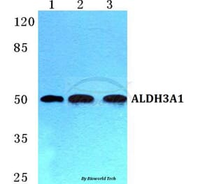 Anti-ALDH3A1 Antibody from Bioworld Technology (BS5605) - Antibodies.com
