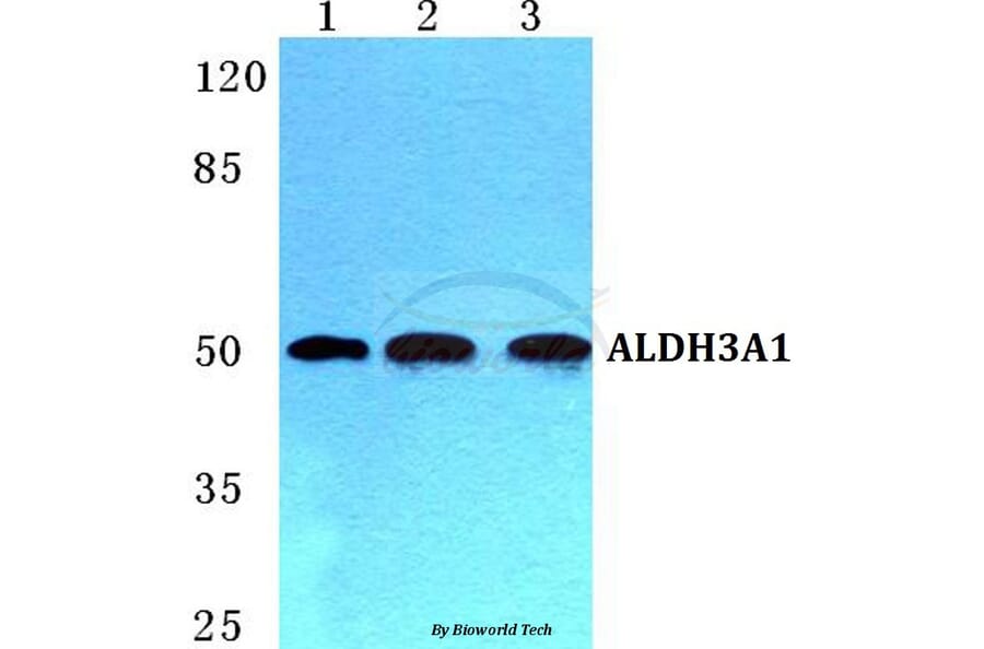 Anti-ALDH3A1 Antibody from Bioworld Technology (BS5605) - Antibodies.com