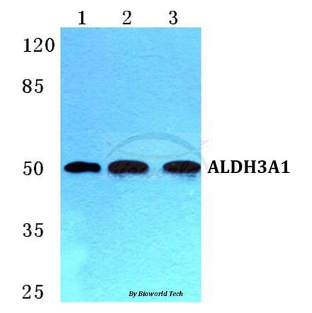 Anti-ALDH3A1 Antibody from Bioworld Technology (BS5605) - Antibodies.com
