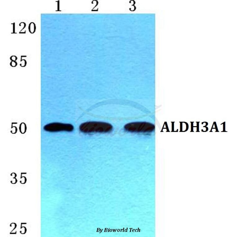 Anti-ALDH3A1 Antibody from Bioworld Technology (BS5605) - Antibodies.com