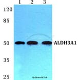 Anti-ALDH3A1 Antibody from Bioworld Technology (BS5605) - Antibodies.com