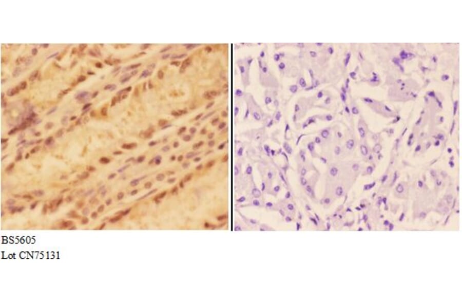 Anti-ALDH3A1 Antibody from Bioworld Technology (BS5605) - Antibodies.com