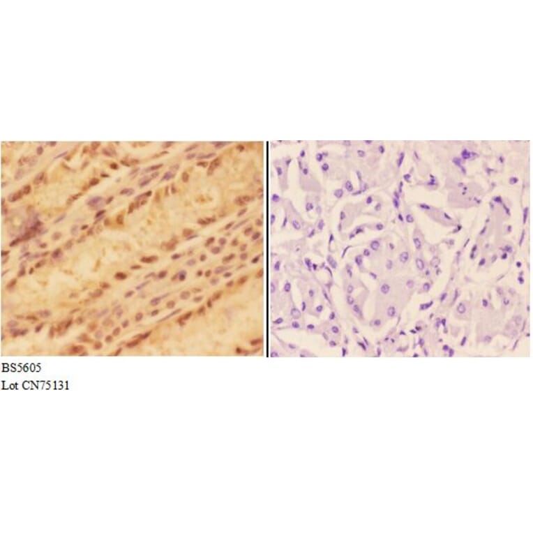 Anti-ALDH3A1 Antibody from Bioworld Technology (BS5605) - Antibodies.com