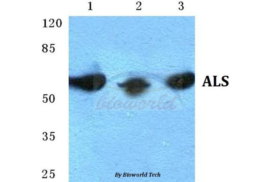 Anti-ALS Antibody from Bioworld Technology (BS5607) - Antibodies.com
