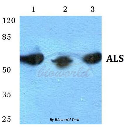 Anti-ALS Antibody from Bioworld Technology (BS5607) - Antibodies.com