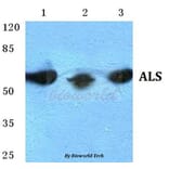 Anti-ALS Antibody from Bioworld Technology (BS5607) - Antibodies.com