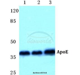 Anti-ApoE Antibody from Bioworld Technology (BS5614) - Antibodies.com