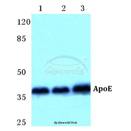 Anti-ApoE Antibody from Bioworld Technology (BS5614) - Antibodies.com