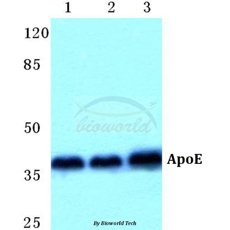 Anti-ApoE Antibody from Bioworld Technology (BS5614) - Antibodies.com