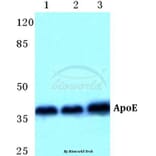 Anti-ApoE Antibody from Bioworld Technology (BS5614) - Antibodies.com