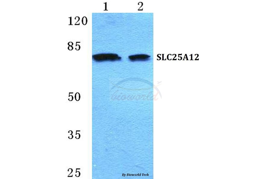 Anti-SLC25A12 Antibody from Bioworld Technology (BS5616) - Antibodies.com
