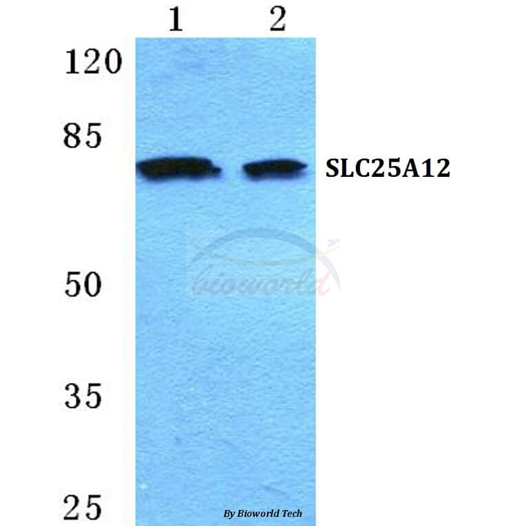 Anti-SLC25A12 Antibody from Bioworld Technology (BS5616) - Antibodies.com