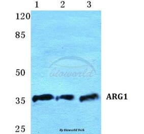 Anti-ARG1 Antibody from Bioworld Technology (BS5618) - Antibodies.com