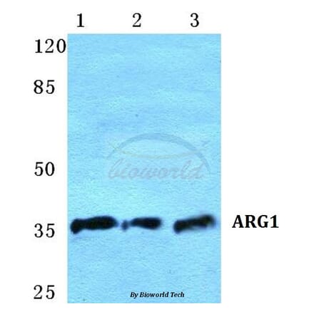 Anti-ARG1 Antibody from Bioworld Technology (BS5618) - Antibodies.com