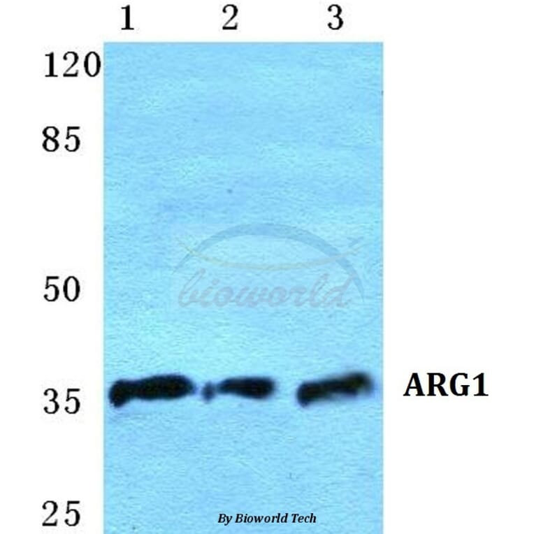 Anti-ARG1 Antibody from Bioworld Technology (BS5618) - Antibodies.com