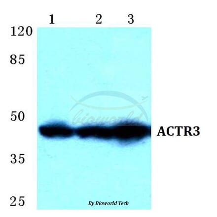 Anti-ACTR3 Antibody from Bioworld Technology (BS5620) - Antibodies.com