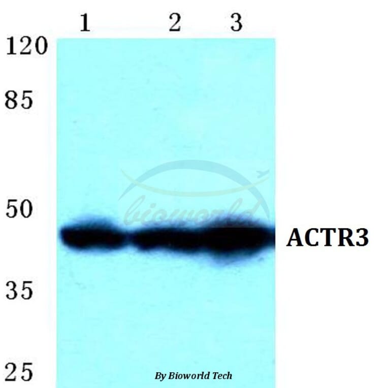 Anti-ACTR3 Antibody from Bioworld Technology (BS5620) - Antibodies.com