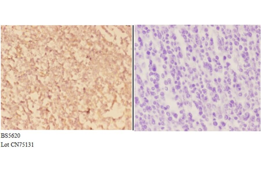 Anti-ACTR3 Antibody from Bioworld Technology (BS5620) - Antibodies.com