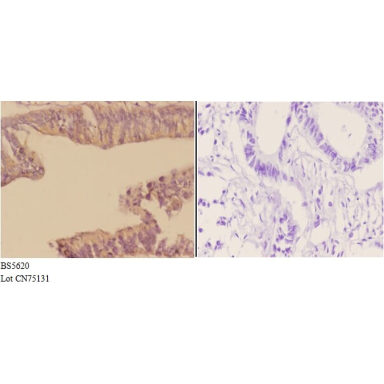 Anti-ACTR3 Antibody from Bioworld Technology (BS5620) - Antibodies.com