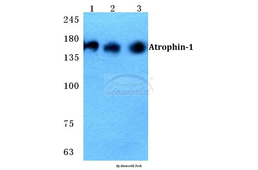 Anti-Atrophin-1 Antibody from Bioworld Technology (BS5625) - Antibodies.com