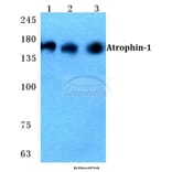 Anti-Atrophin-1 Antibody from Bioworld Technology (BS5625) - Antibodies.com