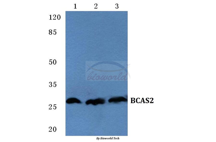 Anti-BCAS2 Antibody from Bioworld Technology (BS5626) - Antibodies.com