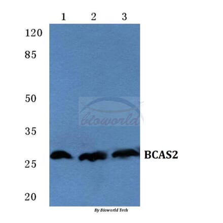Anti-BCAS2 Antibody from Bioworld Technology (BS5626) - Antibodies.com