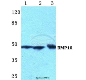 Anti-BMP10 Antibody from Bioworld Technology (BS5628) - Antibodies.com