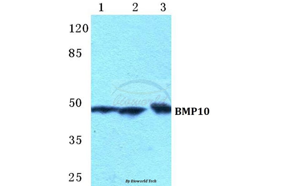 Anti-BMP10 Antibody from Bioworld Technology (BS5628) - Antibodies.com