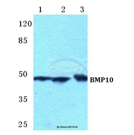 Anti-BMP10 Antibody from Bioworld Technology (BS5628) - Antibodies.com