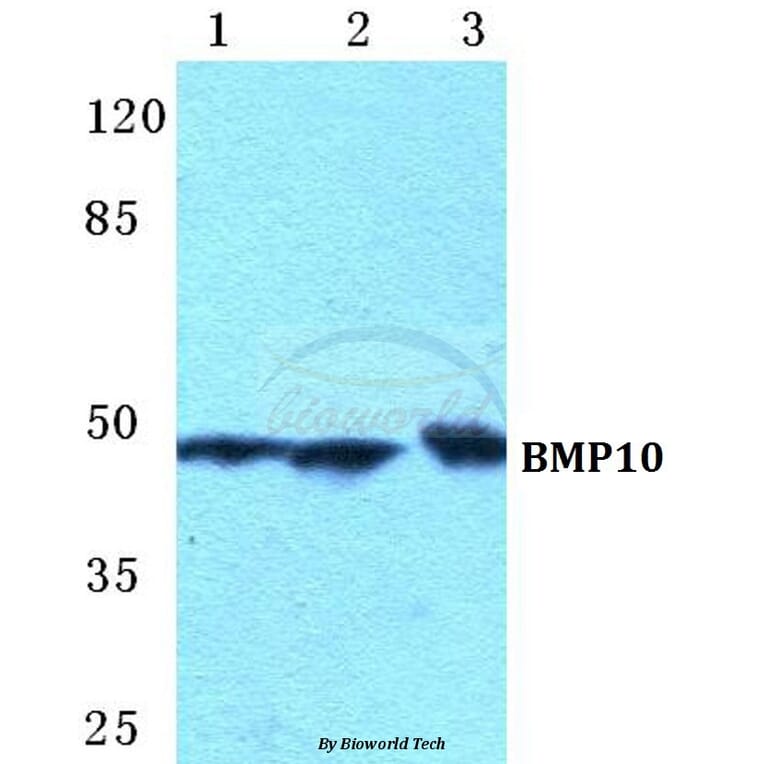 Anti-BMP10 Antibody from Bioworld Technology (BS5628) - Antibodies.com