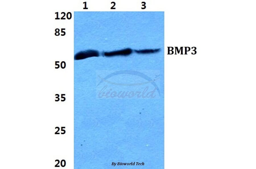 Anti-BMP3 Antibody from Bioworld Technology (BS5629) - Antibodies.com