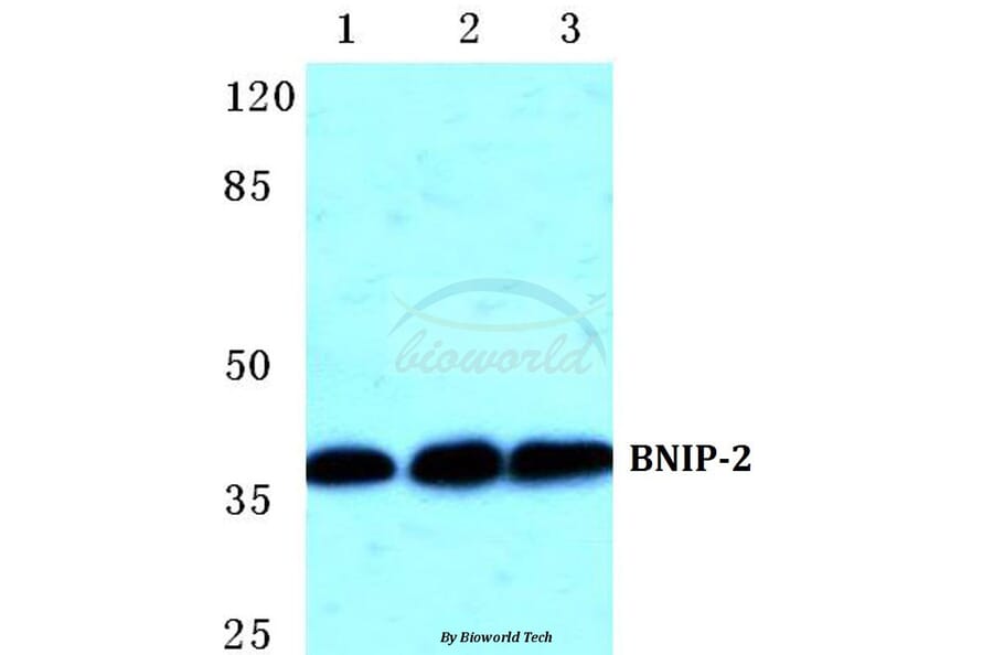 Anti-BNIP-2 Antibody from Bioworld Technology (BS5630) - Antibodies.com