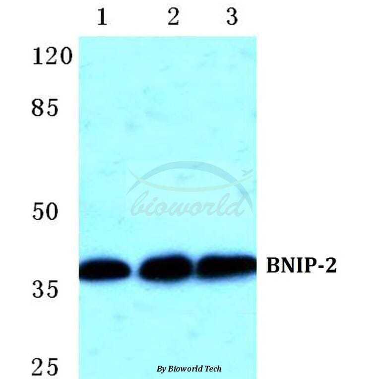 Anti-BNIP-2 Antibody from Bioworld Technology (BS5630) - Antibodies.com