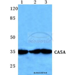 Anti-CA5A Antibody from Bioworld Technology (BS5636) - Antibodies.com