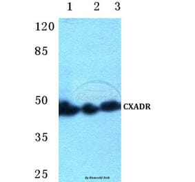 Anti-CXADR Antibody from Bioworld Technology (BS5638) - Antibodies.com