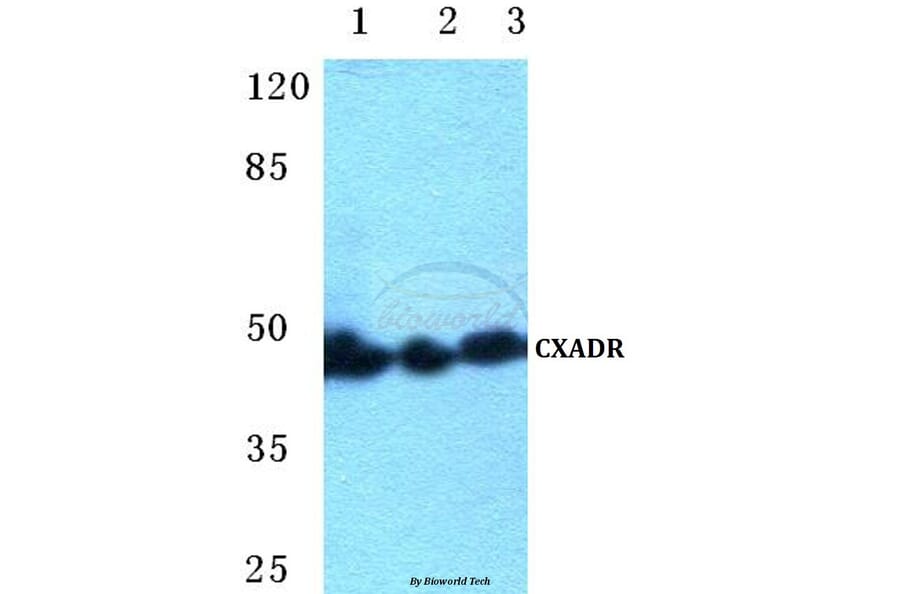 Anti-CXADR Antibody from Bioworld Technology (BS5638) - Antibodies.com