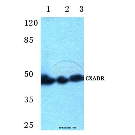 Anti-CXADR Antibody from Bioworld Technology (BS5638) - Antibodies.com