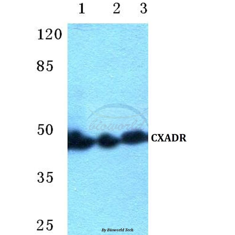 Anti-CXADR Antibody from Bioworld Technology (BS5638) - Antibodies.com