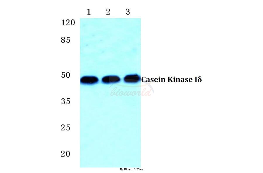 Anti-Casein Kinase Iδ Antibody from Bioworld Technology (BS5640) - Antibodies.com