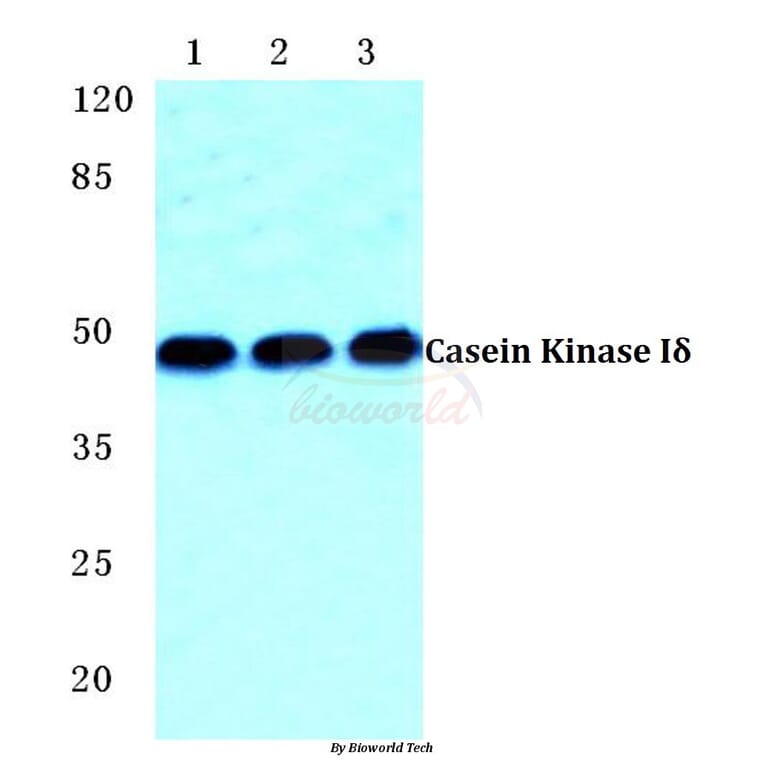 Anti-Casein Kinase Iδ Antibody from Bioworld Technology (BS5640) - Antibodies.com