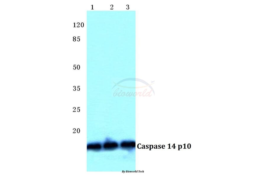 Anti-Caspase 14 p10 Antibody from Bioworld Technology (BS5643) - Antibodies.com