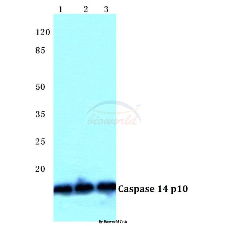 Anti-Caspase 14 p10 Antibody from Bioworld Technology (BS5643) - Antibodies.com