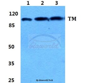 Anti-Thrombomodulin Antibody from Bioworld Technology (BS5650) - Antibodies.com