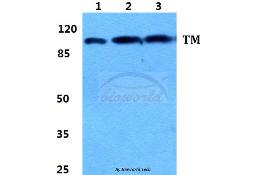 Anti-Thrombomodulin Antibody from Bioworld Technology (BS5650) - Antibodies.com