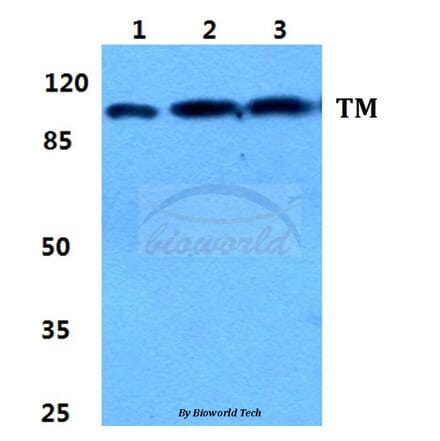 Anti-Thrombomodulin Antibody from Bioworld Technology (BS5650) - Antibodies.com