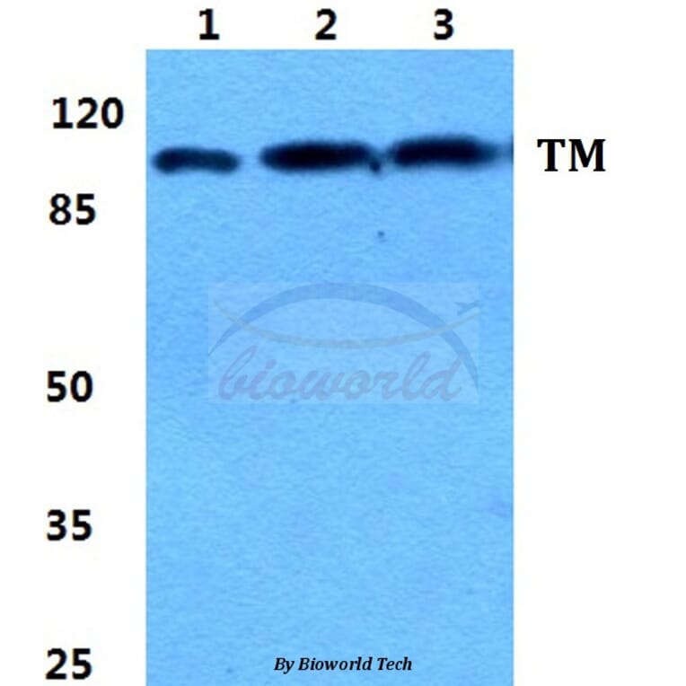 Anti-Thrombomodulin Antibody from Bioworld Technology (BS5650) - Antibodies.com