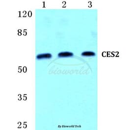 Anti-CES2 Antibody from Bioworld Technology (BS5659) - Antibodies.com