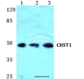 Anti-CHST1 Antibody from Bioworld Technology (BS5662) - Antibodies.com